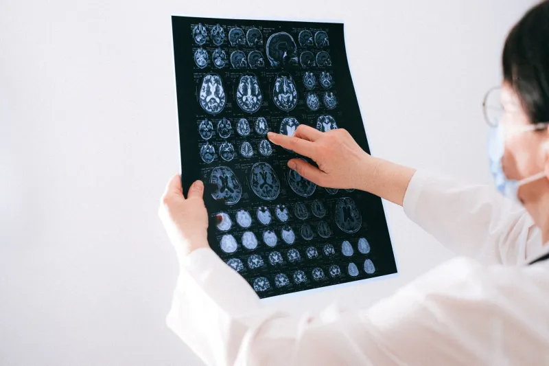 Out of Sync: The Neurotransmitter Phase Conflicts Driving Treatment-Resistant Psychiatric Outcomes